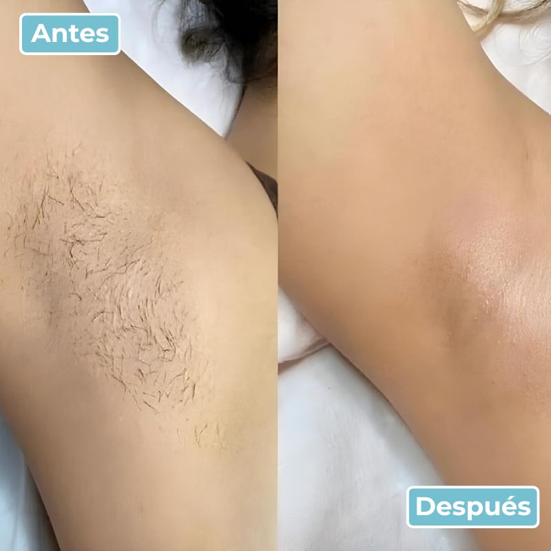 LisoPro™ - Obtenha uma pele suave em segundos