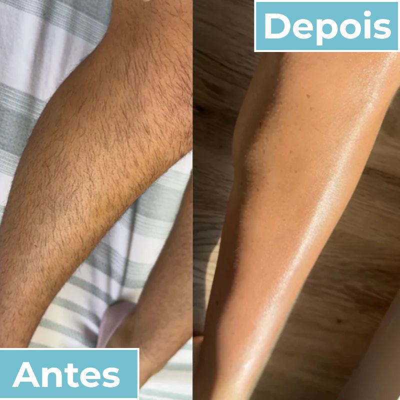 LisoPro™ - Obtenha uma pele suave em segundos