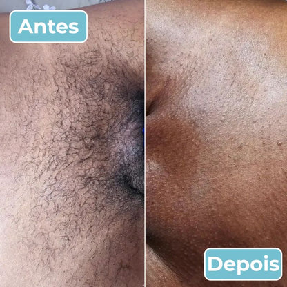 LisoPro™ - Obtenha uma pele suave em segundos